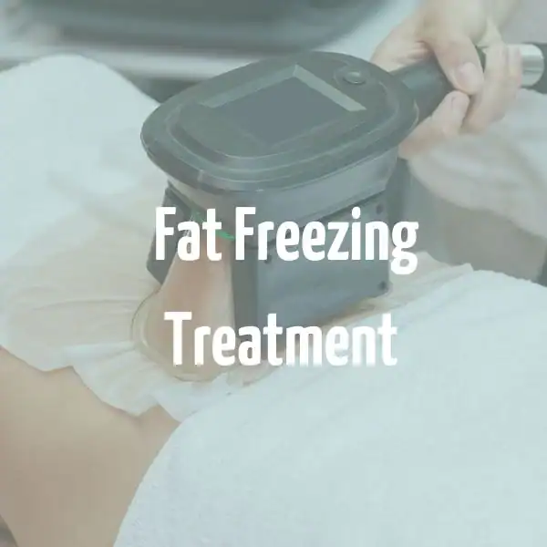 fat freezing treatment Southampton