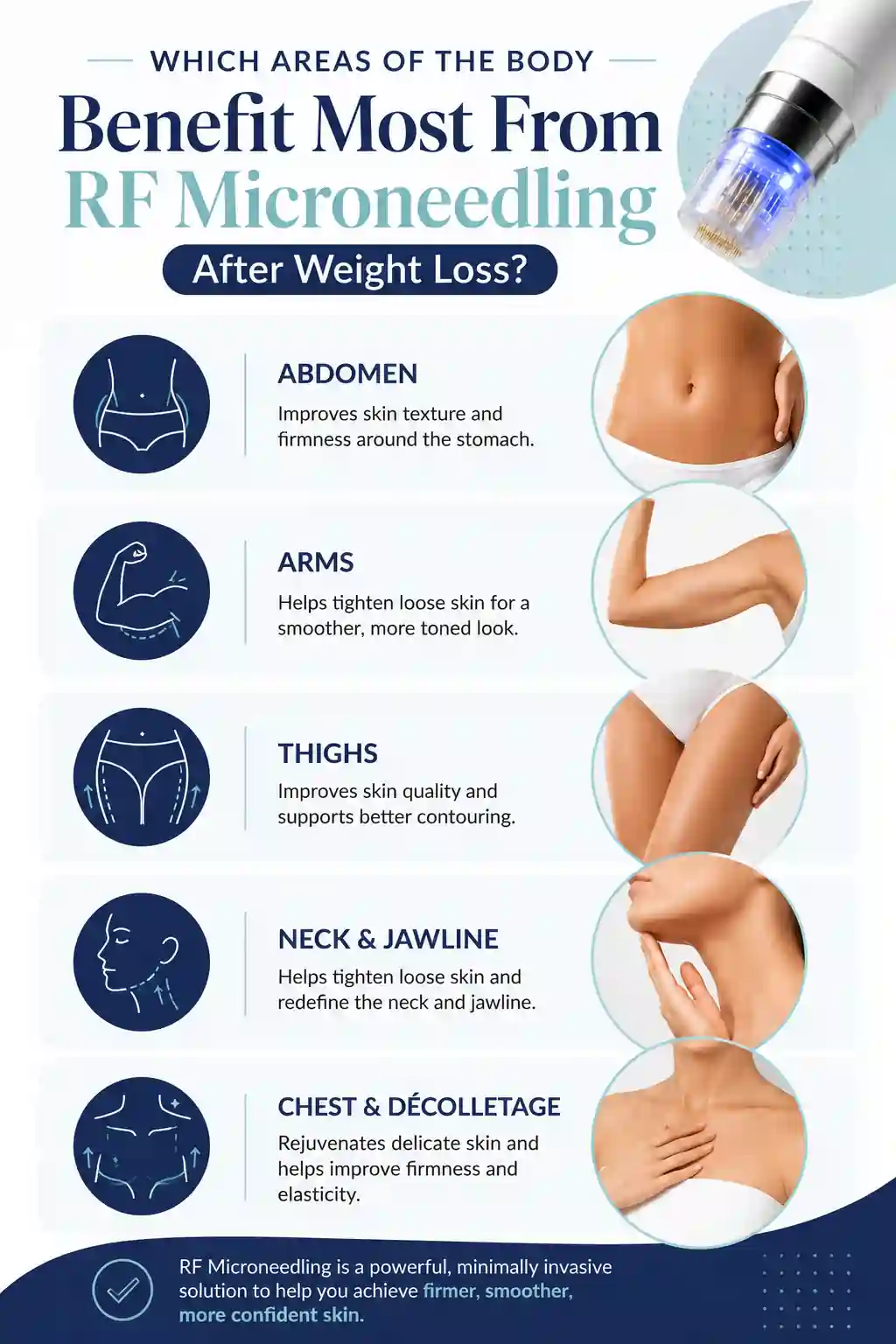 Which Areas of the Body Benefit Most From RF Microneedling After Weight Loss Southampton